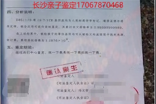衡阳哪儿能做亲子鉴定